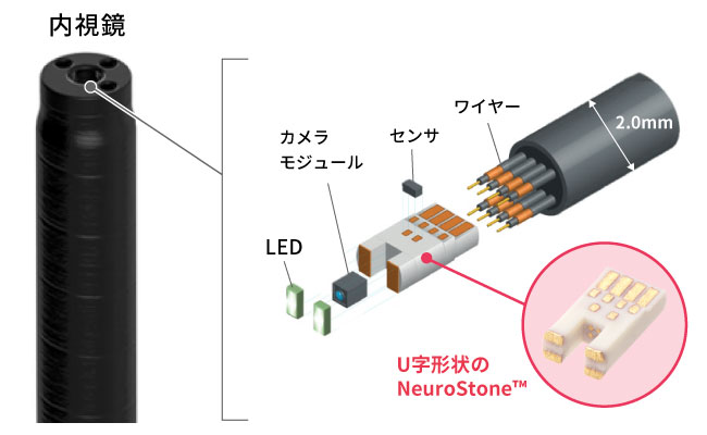 内視鏡の内部にU字に成型したNeuroStoneを設置